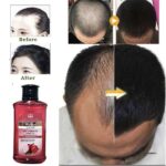 Onion Anti-Hair Loss Oil - 150ml - Image 2