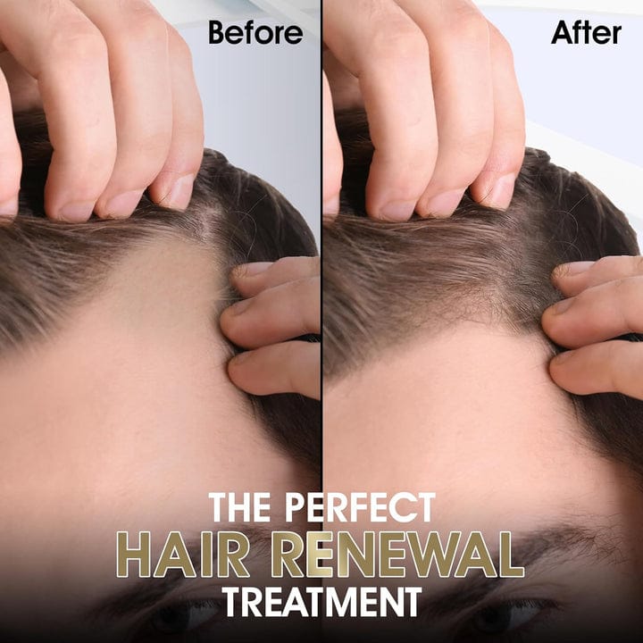 product-image-2 Derma Roller - Image 3